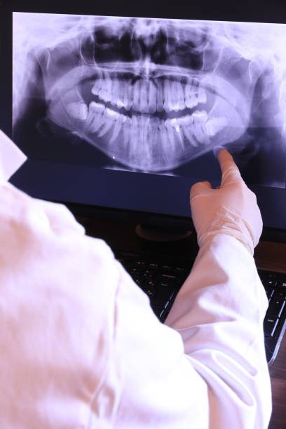 Best Emergency Dental Care for Broken or Chipped Teeth in Lake Wales, FL